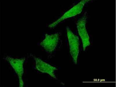 Immunocytochemistry/ Immunofluorescence: RIOK2 Antibody [H00055781-B01P]