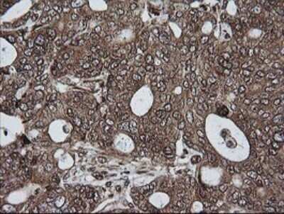 Immunohistochemistry: RIOK2 Antibody (OTI3E11) - Azide and BSA Free [NBP2-73910]