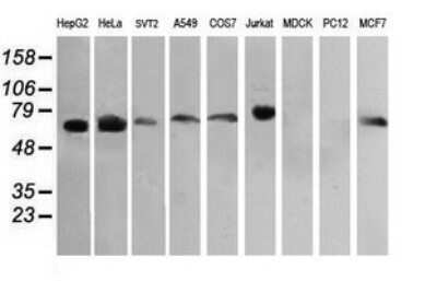 Western Blot: RIOK2 Antibody (OTI3E11)Azide and BSA Free [NBP2-73910]