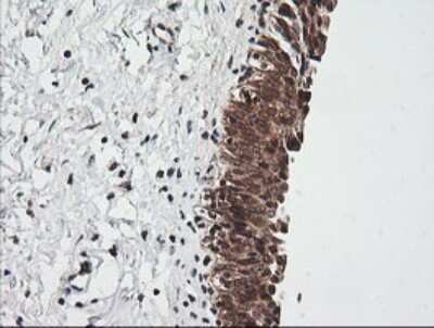Immunohistochemistry: RIOK2 Antibody (OTI3E11) [NBP2-45960]