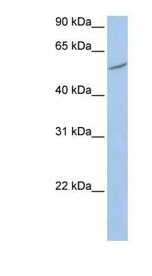 Western Blot: RIOK3 Antibody [NBP1-58215]