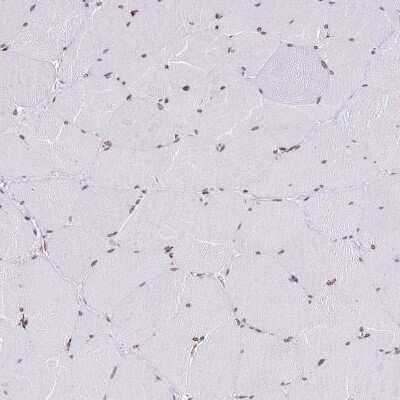 Immunohistochemistry-Paraffin: RIP140 Antibody [NBP2-13674]