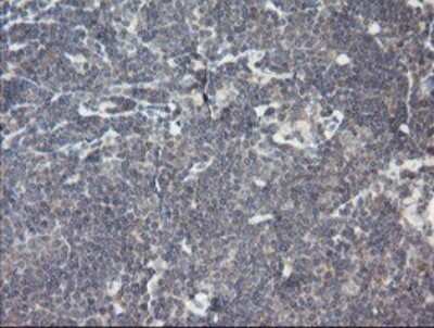 Immunohistochemistry: RIPK1/RIP1 Antibody (OTI2D6) [NBP2-45591]