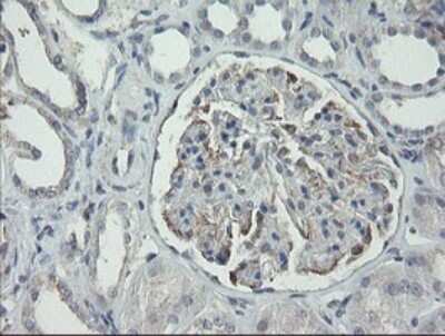 Immunohistochemistry: RIPK1/RIP1 Antibody (OTI2D6) [NBP2-45591]