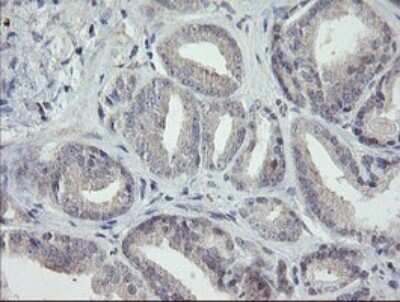 Immunohistochemistry: RIPK1/RIP1 Antibody (OTI2D6) [NBP2-45591]