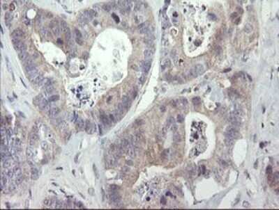 Immunohistochemistry: RIPK1/RIP1 Antibody (OTI2D6) - Azide and BSA Free [NBP2-73911]