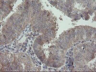 Immunohistochemistry: RIPK1/RIP1 Antibody (OTI2D6) - Azide and BSA Free [NBP2-73911]