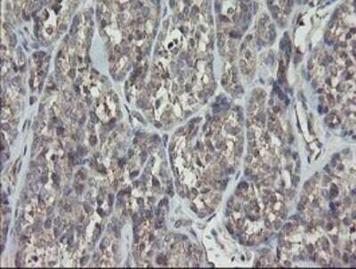Immunohistochemistry: RIPK1/RIP1 Antibody (OTI2D6) - Azide and BSA Free [NBP2-73911]