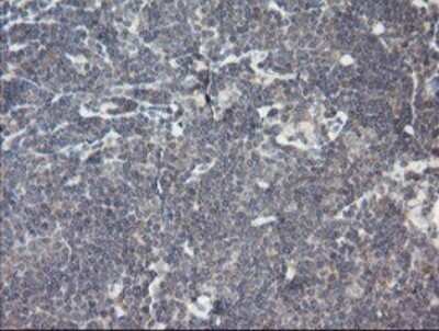 Immunohistochemistry: RIPK1/RIP1 Antibody (OTI2D6) - Azide and BSA Free [NBP2-73911]