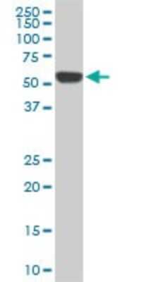 Western Blot: RIPK2 Antibody (2C7) [H00008767-M01]