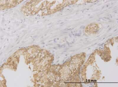 Immunohistochemistry-Paraffin: RIPK2 Antibody (3D9) [H00008767-M03]