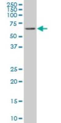 Western Blot: RIPK2 Antibody (3D9) [H00008767-M03]