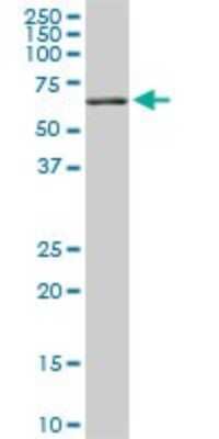 Western Blot: RIPK2 Antibody (3D9) [H00008767-M03]