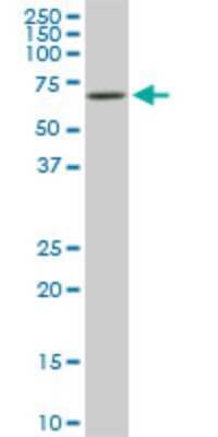 Western Blot: RIPK2 Antibody (3D9) [H00008767-M03]