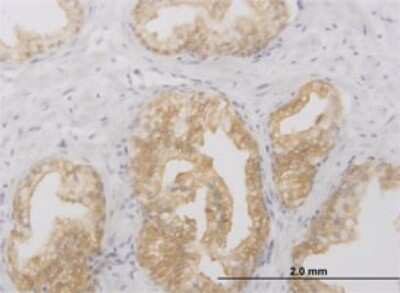 Immunohistochemistry-Paraffin: RIPK2 Antibody (6F7) [H00008767-M02]