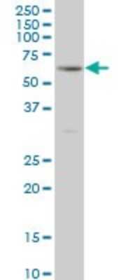 Western Blot: RIPK2 Antibody (6F7) [H00008767-M02]