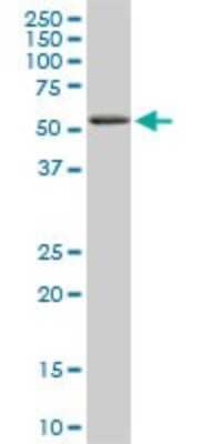 Western Blot: RIPK2 Antibody (6F7) [H00008767-M02]