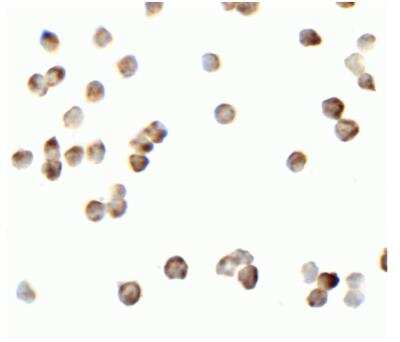 Immunocytochemistry/ Immunofluorescence: RIPK2 Antibody - BSA Free [NBP1-76960]