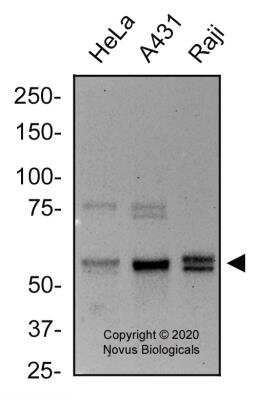 Western Blot: RIPK2 AntibodyBSA Free [NBP1-32424]