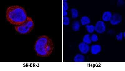 Immunocytochemistry/ Immunofluorescence: RIPK3/RIP3 Antibody (1312D) - Azide and BSA Free [NBP2-80926]