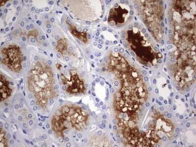 Immunohistochemistry: RIPK3/RIP3 Antibody (OTI1B3) [NBP2-45592]