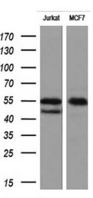 Western Blot: RIPK3/RIP3 Antibody (OTI1B3) [NBP2-45592]