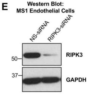 Knockdown Validated: RIPK3/RIP3 Antibody - BSA Free [NBP1-77299]
