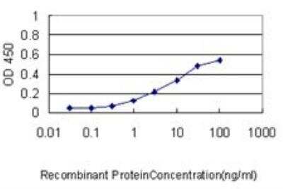 ELISA: RIPK4 Antibody (2G3) [H00054101-M01]