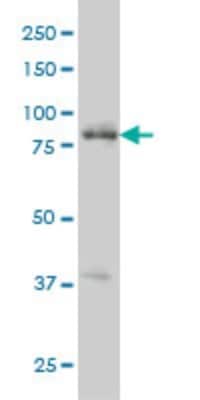 Western Blot: RIPK4 Antibody (2G3) [H00054101-M01]