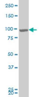 Western Blot: RIPK4 Antibody (4H5) [H00054101-M04]