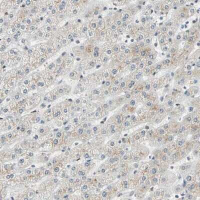 Immunohistochemistry-Paraffin: RIZ1 Antibody [NBP1-89644]