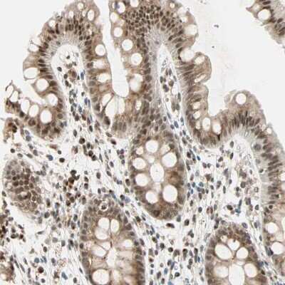Immunohistochemistry-Paraffin: RIZ1 Antibody [NBP1-89644]