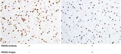Immunohistochemistry-Paraffin: RIZ1 Antibody [NBP2-99748]