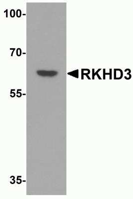 Western Blot: RKHD3 AntibodyBSA Free [NBP2-81777]