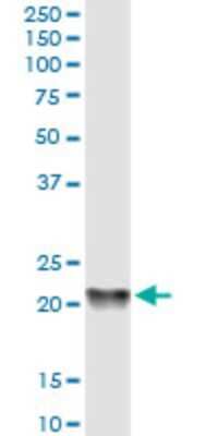 Western Blot: RKIP/PBP Antibody (2G2-1F1) [H00005037-M01]
