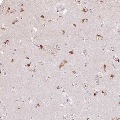 Immunohistochemistry: RLBP1L1 Antibody [NBP2-47508]
