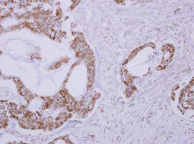 Immunohistochemistry-Paraffin: RLBP1L1 Antibody [NBP2-20170]