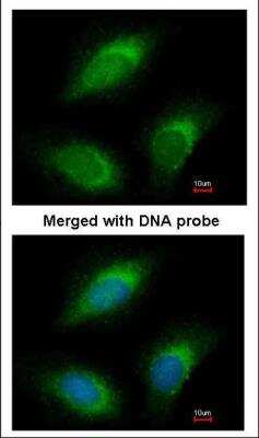 Immunocytochemistry/ Immunofluorescence: RLF Antibody [NBP1-33086]