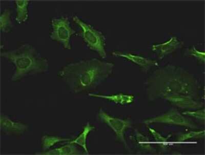 Immunocytochemistry/ Immunofluorescence: RLK/TXK Antibody (2D8) [H00007294-M01]