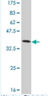 Western Blot: RLK/TXK Antibody (2G10) [H00007294-M02]