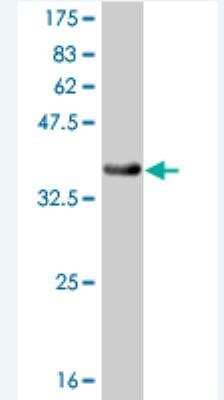 Western Blot: RLK/TXK Antibody (2G3) [H00007294-M03]