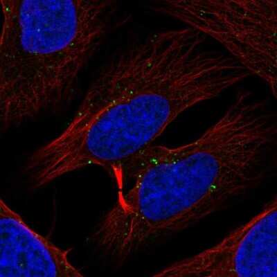 Immunocytochemistry/ Immunofluorescence: RLK/TXK Antibody [NBP2-56302]