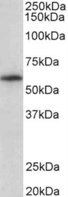 Western Blot: RLK/TXK Antibody [NBP1-37000]