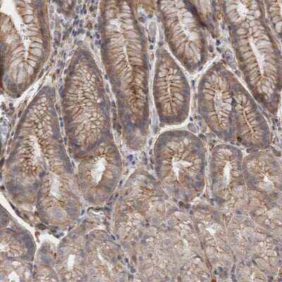 Immunohistochemistry-Paraffin: RMD1 Antibody [NBP1-88089]