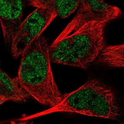 Immunocytochemistry/ Immunofluorescence: RMND5A Antibody [NBP2-56367]