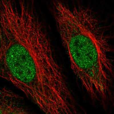 Immunocytochemistry/ Immunofluorescence: RMND5B Antibody [NBP2-13234]