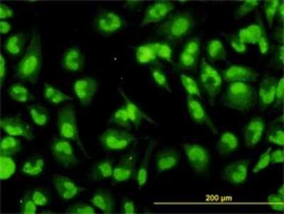 Immunocytochemistry/ Immunofluorescence: RNA Helicase A Antibody (3G7) [H00001660-M01]