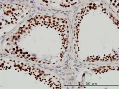 Immunohistochemistry-Paraffin: RNA Helicase A Antibody (3G7) [H00001660-M01]