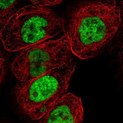 Immunocytochemistry/ Immunofluorescence: RNA Helicase A Antibody [NBP1-85266]