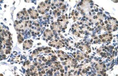 Immunohistochemistry-Paraffin: RNA Helicase A Antibody [NBP1-57334]